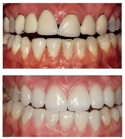 Customer result photo