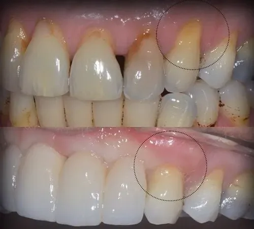 Customer result image